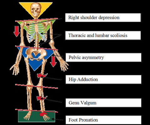 We assess Kinetic Chain Dysfunction