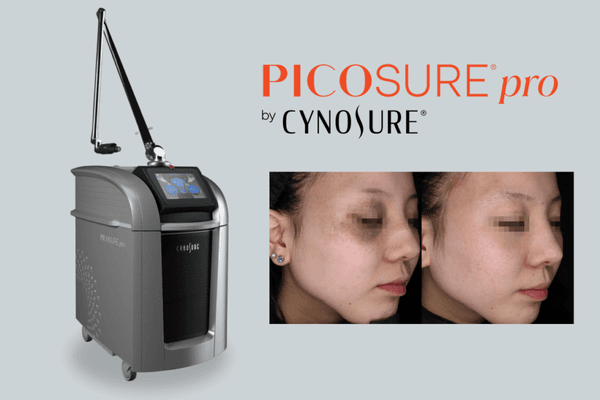 PicoSure Laser