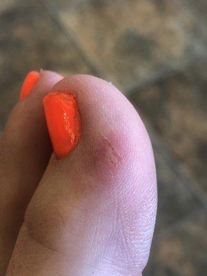 Cut on my toe