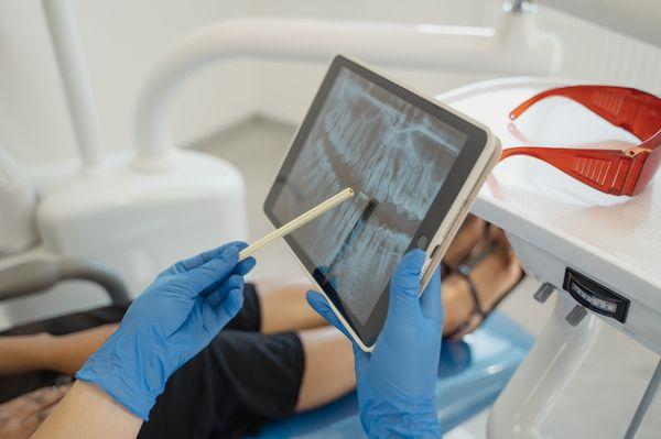 Radiographs help us diagnose many different dental pathologies. Call us today to schedule your dental exam!