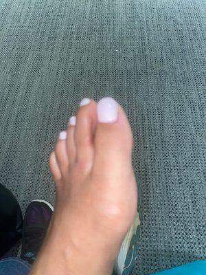 My toe nails