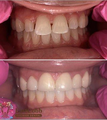 We love making your smile beautiful!