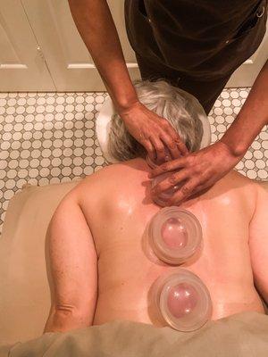 Medicupping allows the therapist to work deep within the muscle to speed up the healing process.