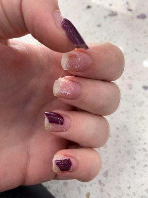 Look at the damage to her nail beds