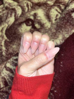 Injured cuticles