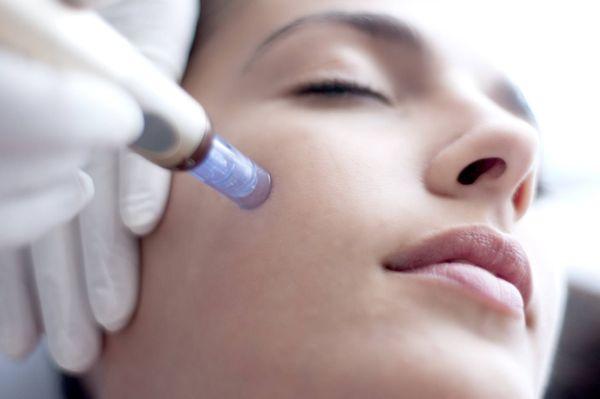 Skin Treatments: Microneedle, RF Skin Tightening, Microderm, Custom Facials and Photofacials