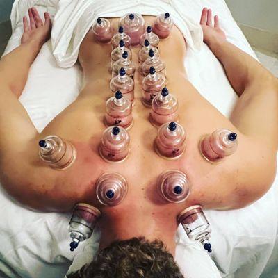 Cupping + Deep Tissue