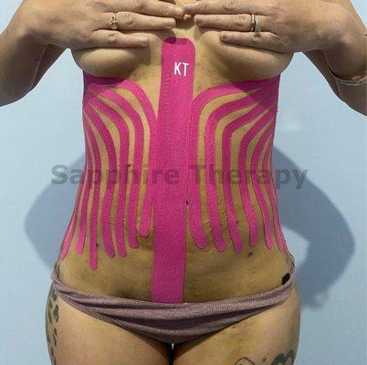 Kinesio Tape to reduce swelling, edema and pain