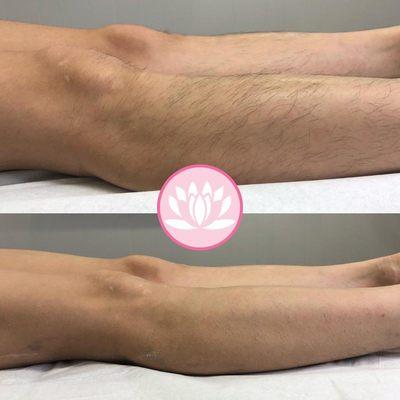 Before and after leg wax!!