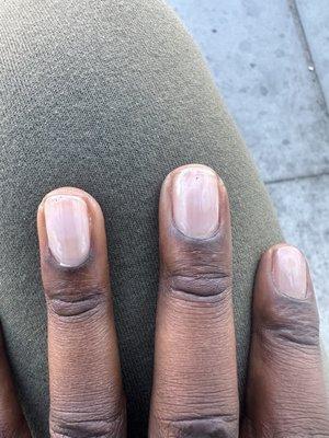 Black spots on nails