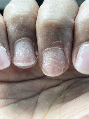 Damaged Nails