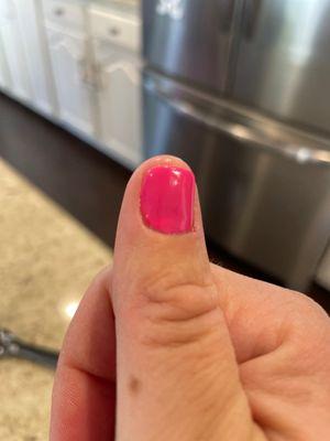 Different colors on the nail?