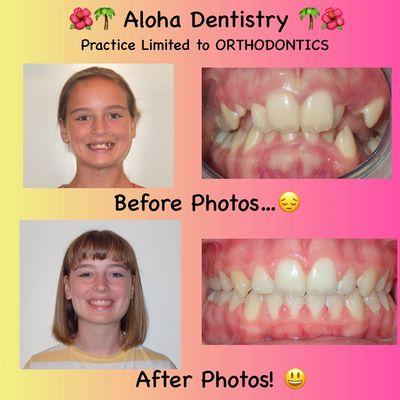 Thank You for Choosing Aloha for your families orthodontic Needs!