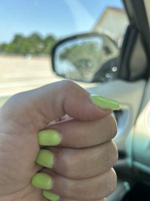 Both thumb nails are wavy. It's a little blurry but the cuticle is very bumpy and the middle of the mail is skinny.