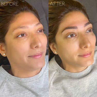 Before and after microblading