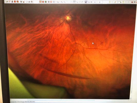 Tennessee Retina PC