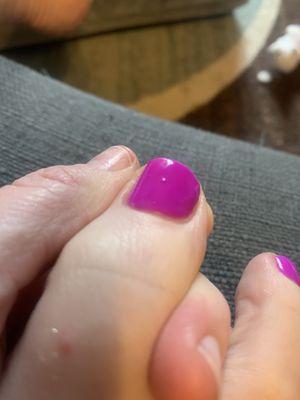 Something hard under polish same toe different spot