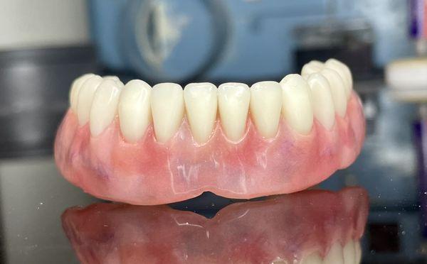 Lower Denture