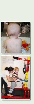 Pediatric Therapy