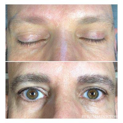 Microbladed Eyebrows (Microblading)