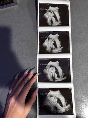 The amazing pictures I got, outside the facility, and inside the ultrasound room!