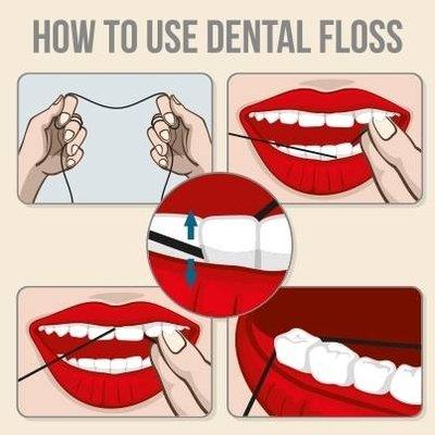 Flossing removes plaque between teeth that your toothbrush can't reach. We recommend flossing at least once a day