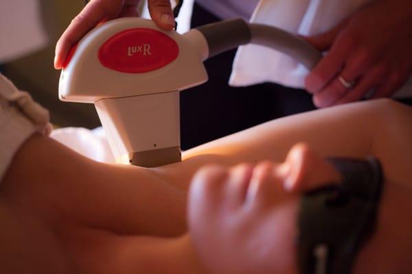 Laser Hair Removal