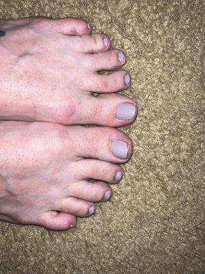 Awful pedicure