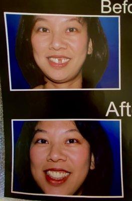 Before and After dental care, call the office to discuss your dental concerns