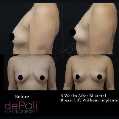 DePoli Plastic Surgery