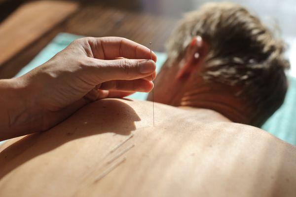 Aspen Acupuncture And Herbal Medicine