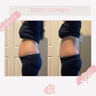 Before and after - Body Combo