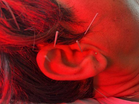 Auricular acupuncture points