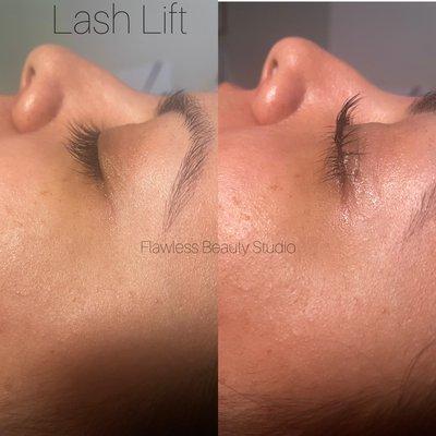 Lash lift