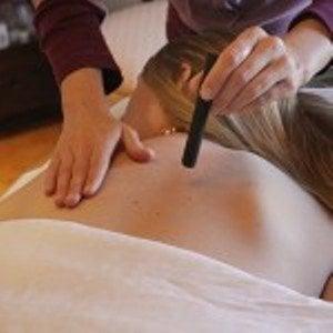 Denver Acupuncturist