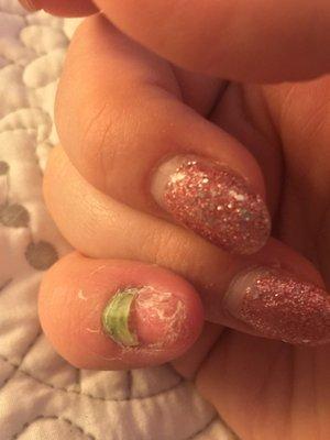 They used a dirty electric file and dug too deep into my nail bed. Now my nail has fallen off and my cuticle is green.