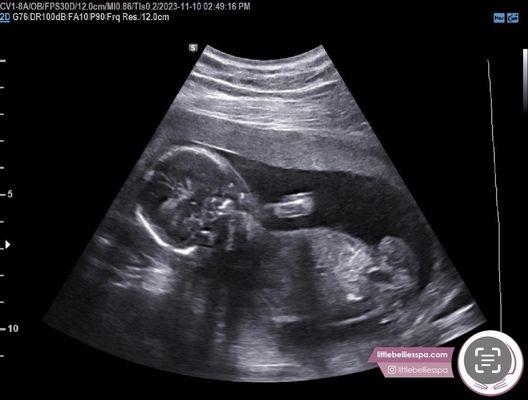 Our ultrasound photo of our baby boy and 1 of the 10 photos we got while there. We also got digital copies emailed to us.