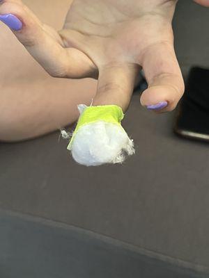 My friend had to put neosporin and gauze on her finger and wrap it