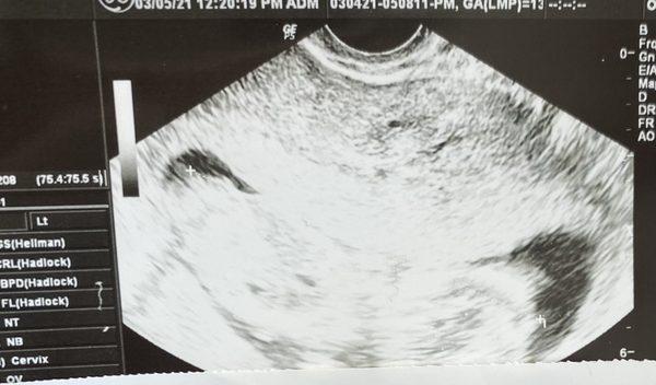 Careless ultrasound photos