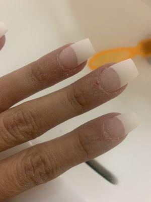 Bad nail job and cuts