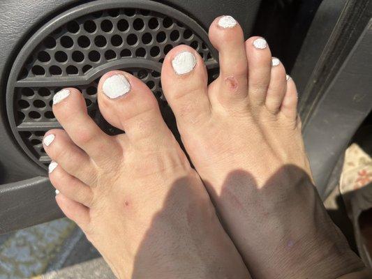 Bad pedi paint job