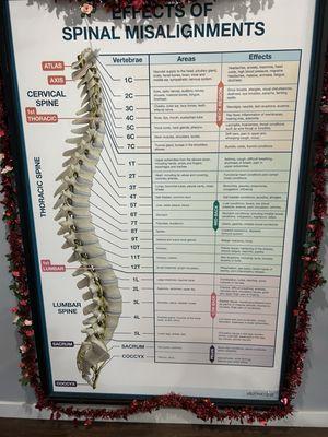 Effects of spinal misalignment