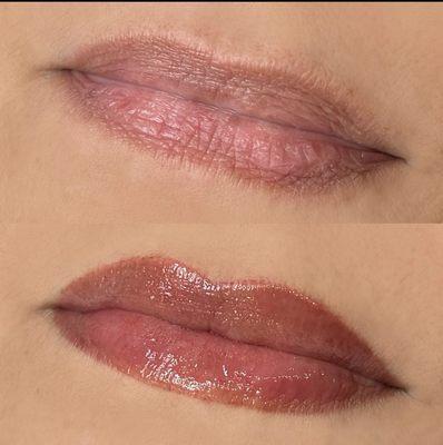 Natural symmetry enhancement lip blush