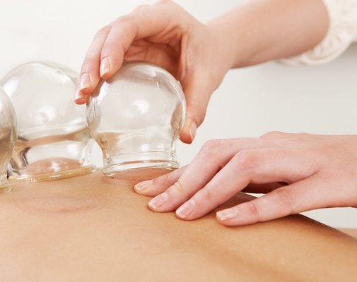 Cupping along with acupuncture treats muscle pain and tightness, relieves stress and leaves you super relaxed!