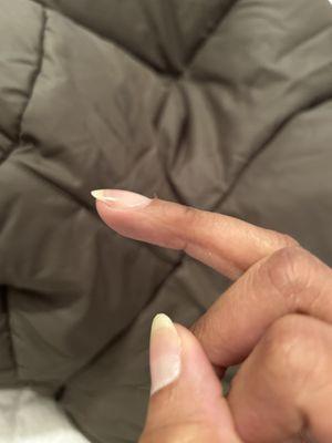 How could all my cuticles look like this one day after a "manicure".. all of my nails look like this