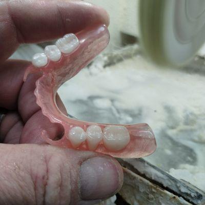 Flexible partial dentures