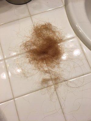 The hair that was coming out in clumps.