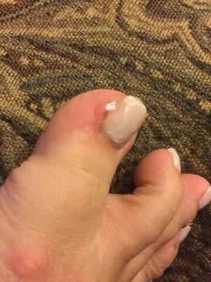 be careful and don't go here! It's my toes infected after a pedicure at this location!