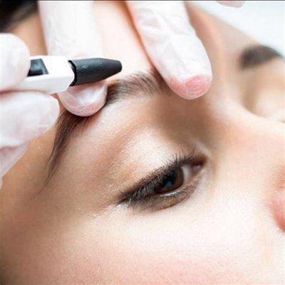 Brow Shaping with Electrolysis.