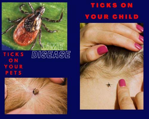 Ticks